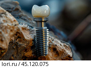 Dental implant standing on a rock displaying its strength and durability. Стоковое AI-изображение, AI-художник Иван Рябоконь / Фотобанк Лори