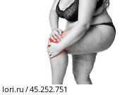 Knee pain, fat woman with joint arthritis, overweight female body isolated on white background. Стоковое фото, фотограф Станислав Тарко / Фотобанк Лори