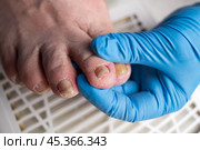 Hardware pedicure, ingrown toenail, elderly woman with cracked skin on her foot at a podiatrist's appointment, chiropody and podology concept. Стоковое фото, фотограф Станислав Тарко / Фотобанк Лори