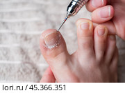 Hardware pedicure for yourself, ingrown toenail, chiropody and podology concept, foot care. Стоковое фото, фотограф Станислав Тарко / Фотобанк Лори