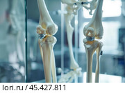 Artificial knee joint replacing damaged joint on anatomical model. Стоковое AI-изображение, AI-художник Иван Рябоконь / Фотобанк Лори