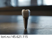 Dental implant standing on a reflective surface representing modern dentistry. Стоковое AI-изображение, AI-художник Иван Рябоконь / Фотобанк Лори