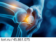 Person holding their knee experiencing joint pain with highlighted bones. Стоковое AI-изображение, AI-художник Иван Рябоконь / Фотобанк Лори