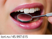 Dental examination, woman with toothache, periodontal disease in wisdom teeth, gum inflammation, dental pain, health problems concept. Стоковое AI-изображение, AI-художник Станислав Тарко / Фотобанк Лори
