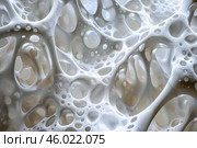 Osteoporosis affecting bone structure, weakening and increased porosity. Стоковое AI-изображение, AI-художник Иван Рябоконь / Фотобанк Лори