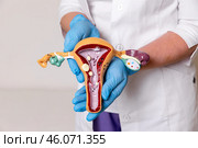 Doctor or nurse holding pathology Uterus and Ovaries model. Ovarian and Cervical cancer, Cervix disorder, Endometriosis, Hysterectomy, Uterine fibroids, Reproductive system and Pregnancy concept. Стоковое фото, фотограф Ирина Михайличенко / Фотобанк Лори