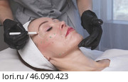 Close-up. Before the procedure for facial contouring or plastic surgery, the cosmetologist makes markings on the patient face. Time to prepare for a cosmetic procedure. Footage. Стоковое видео, видеограф Ирина Михайличенко / Фотобанк Лори