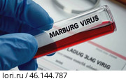 Doctor Scientist holding a test blood sample of Marburg Virus. Hand in blue glove with Laboratory tube for analysis. New epidemic illness. Outbreak of infectious disease spreading, worldwide pandemic. Стоковое AI-видео, аниматор Марина Демидюк / Фотобанк Лори