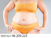 Tummy tuck, flabby skin on a fat belly, abdomen with obesity and cellulite, saggy stomach, plastic surgery concept on gray background. Стоковое фото, фотограф Станислав Тарко / Фотобанк Лори