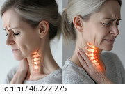 An elderly woman with a pained expression on her face, holding her neck. The visually superimposed effect shows the cervical vertebrae highlighted, symbolizing pain or problems with the spine. The photo consists of two frames: in the first, the woman is holding her neck from the front, and in the second, from the side. This may indicate problems with cervical osteochondrosis, inflammation, or pinched nerves. Стоковое AI-изображение, AI-художник Анна Кривицкая / Фотобанк Лори