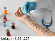 Doctor making allergy skin test on patient's hand in clinic, closeup. Стоковое фото, фотограф Pixel_shot / Фотобанк Лори