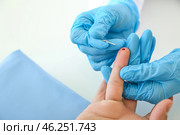 Doctor using lancet to get blood sample for test, closeup. Стоковое фото, фотограф Pixel_shot / Фотобанк Лори