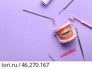 Model of jaw with dental braces and dentist tools on lilac background. Стоковое фото, фотограф Pixel_shot / Фотобанк Лори