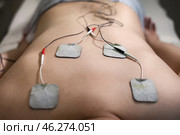 A person lies on a therapy table, receiving electrotherapy treatment. Electrodes are affixed to their lower back, promoting relaxation and alleviating tension in a soothing wellness environment. Стоковое фото, фотограф Aleksandr Golubev / Фотобанк Лори