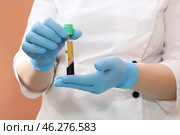Blood plasma for PRP therapy. Стоковое фото, фотограф Ольга Зиновская / Фотобанк Лори