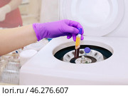 Medical vial with blood plasma in hand for PRP extracted from the centrifuge machine. Стоковое фото, фотограф Ольга Зиновская / Фотобанк Лори