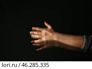 Hands of woman suffering from Parkinson syndrome on dark background. Стоковое фото, фотограф Pixel_shot / Фотобанк Лори