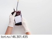 Hands in gloves holding blood pack for transfusion on white background. Стоковое фото, фотограф Pixel_shot / Фотобанк Лори