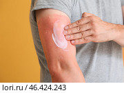 Man with red sunburned skin applying cream against color background, closeup. Стоковое фото, фотограф Pixel_shot / Фотобанк Лори