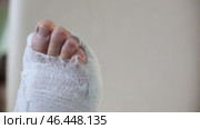 plaster cast leg. toes moving. plain background, close-up. Стоковое видео, видеограф Кутина Татьяна / Фотобанк Лори