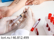 Молодая женщина проходит процедуру кожных проб аллергена в клинике. Стоковое фото, фотограф Pixel_shot / Фотобанк Лори