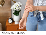 Аллергичная молодая женщина чешет себя в спальне, крупным планом. Стоковое фото, фотограф Pixel_shot / Фотобанк Лори