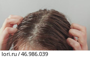 Woman scratching itchy scalp, feeling discomfort. Стоковое видео, видеограф Илья Шаматура / Фотобанк Лори