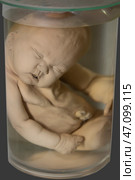 April 1, 2023. Belarus, Minsk. Exhibition of anatomical exhibits. Human infant with pathological development of sirenomelia. Human mermaid. Редакционное фото, фотограф Лазаренко Светлана / Фотобанк Лори