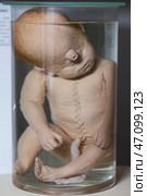 April 1, 2023. Belarus, Minsk. Exhibition of anatomical exhibits. Human infant with pathological development of cyclopia. Embryos in banks. Редакционное фото, фотограф Лазаренко Светлана / Фотобанк Лори