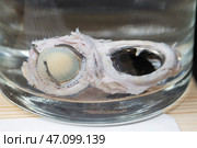 April 1, 2023. Belarus, Minsk. Exhibition of an anatomical exhibit of the human heart in the section with an artificial valve. Редакционное фото, фотограф Лазаренко Светлана / Фотобанк Лори