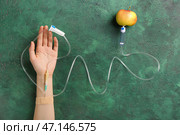 Женская рука с капельницей и яблоком на цветном фоне. Концепция анорексии. Стоковое фото, фотограф Pixel_shot / Фотобанк Лори