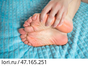 Woman giving herself foot massage, corns and calluses on feet, dry skin on legs, cracked heels. Стоковое фото, фотограф Станислав Тарко / Фотобанк Лори
