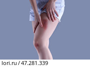 Молодая женщина с ушибом ноги на сером фоне. Стоковое фото, фотограф Pixel_shot / Фотобанк Лори