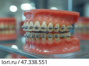 Model of teeth with braces displayed in a dental clinic for patient education. Модель зубов с брекетами, выставленная в стоматологической клинике для обучения пациентов. Стоковое AI-изображение, AI-художник Katsiaryna Repich / Фотобанк Лори