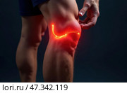 Male athlete with pumped up legs with knee injury. Pain in kneecap pierces and burns. Стоковое AI-изображение, AI-художник Коханова Наталья / Фотобанк Лори