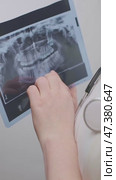 Female dentist analyzes two X-rays to detect changes and make an accurate diagnosis for the patient. Стоковое видео, видеограф Svetlana Golovco / Фотобанк Лори