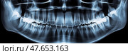 Dental health: panoramic radiograph, diagnostic tool for oral evaluation, medical assessment. Стоковое AI-изображение, AI-художник Данила Большаков / Фотобанк Лори