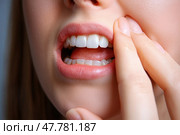 Young woman suffering from herpes on lips, health problems concept. Стоковое AI-изображение, AI-художник Станислав Тарко / Фотобанк Лори