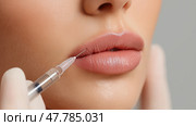 Close-Up of Lip Filler Injection – Needle and Syringe Procedure on Woman's Lips. Филлер для губ - один из самых популярных видов дермальных наполнителей, которые вводятся в губы женщины иглой и шприцем крупным планом. Стоковое AI-изображение, AI-художник Katsiaryna Repich / Фотобанк Лори