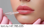Close-Up of Lip Filler Injection – Needle and Syringe Procedure on Woman's Lips. Филлер для губ - один из самых популярных видов дермальных наполнителей, которые вводятся в губы женщины иглой и шприцем крупным планом. Стоковое AI-изображение, AI-художник Katsiaryna Repich / Фотобанк Лори
