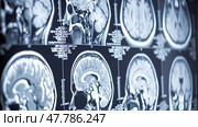 Detailed MRI images displaying the structure and activity of the human brain. Стоковое AI-изображение, AI-художник Данила Большаков / Фотобанк Лори