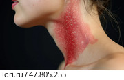 Healing Scar on a Person's Neck Post-Thyroid Surgery, Indicating Recovery. Стоковое AI-изображение, AI-художник Sergey Grishin / Фотобанк Лори