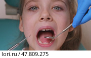 Close up dentist, doctor examines the oral cavity of a little girl, uses a mouth mirror, baby teeth close-up. Concept of pediatric dentistry, dental treatment. Slow motion footage. Стоковое видео, видеограф Ирина Михайличенко / Фотобанк Лори