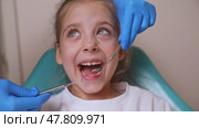 Close up dentist, doctor examines the oral cavity of a little girl, uses a mouth mirror, baby teeth close-up. Concept of pediatric dentistry, dental treatment. Slow motion footage. Стоковое видео, видеограф Ирина Михайличенко / Фотобанк Лори