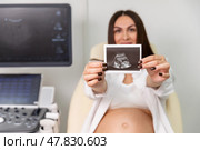 Happy young pregnant woman holding and showing ultrasound scan photo. Smiling mother with sonogram of her unborn baby. Concept of pregnancy. Maternity prenatal care. Стоковое фото, фотограф Ирина Михайличенко / Фотобанк Лори