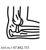 dislocated joint fracture line icon vector illustration. Стоковая иллюстрация, иллюстратор Vectorwin / Фотобанк Лори