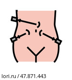 laparoscopy bariatric color icon vector illustration. Стоковая иллюстрация, иллюстратор Vectorwin / Фотобанк Лори