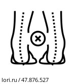 outward curvature of legs line icon vector illustration. Стоковая иллюстрация, иллюстратор Vectorwin / Фотобанк Лори