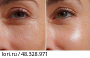 Skincare Cream Before/After, Cracked Dry Skin vs Smooth Glow in Zoomed-In Split. Крем для ухода за кожей до и после, потрескавшаяся сухая кожа против гладкого сияния в увеличенном разрезе. Стоковое AI-изображение, AI-художник Katsiaryna Repich / Фотобанк Лори