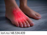 Joint diseases, hallux valgus, plantar fasciitis, woman's leg hurts, pain in the foot, female feet closeup, health problems concept. Стоковое AI-изображение, AI-художник Станислав Тарко / Фотобанк Лори